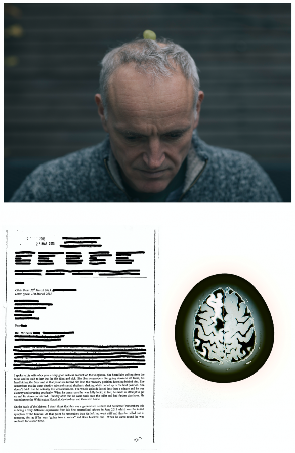 Portrait vs loss of consciousness description & MRI scan