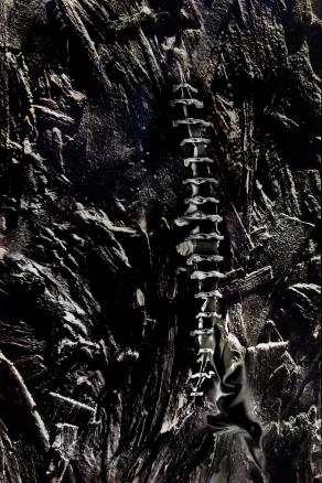 acromia satturata in continua lacrimazione.