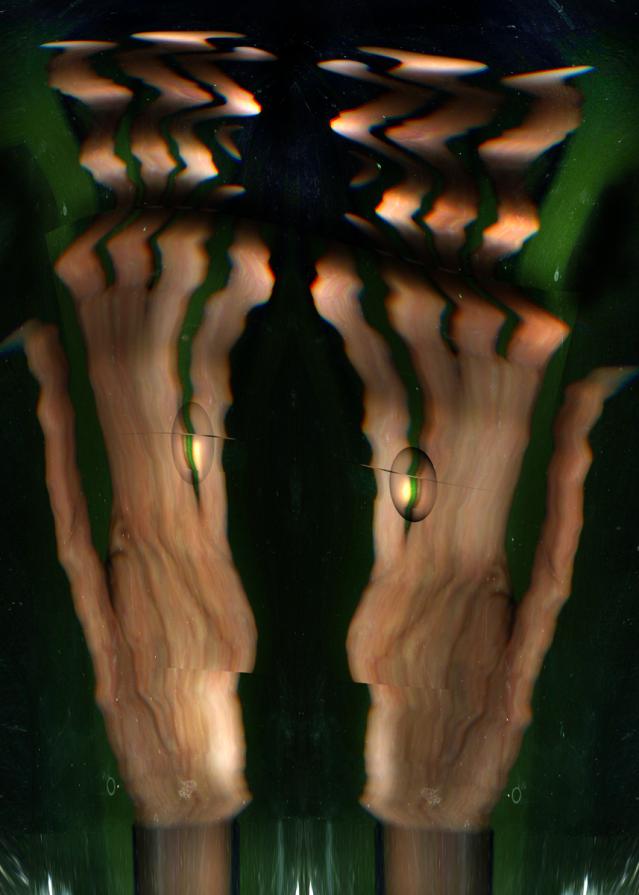 la bipolarita genera un condannato a morte certa. la bipolarita genera un condannato a morte certa.