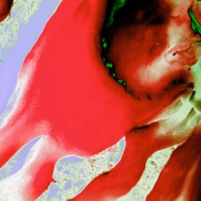 Strappare il Dente di Luis