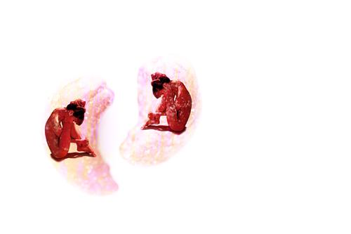 Two Heart Lonely #2 Two Heart Lonely #2