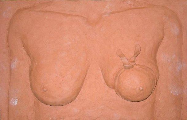 "Sequenza di quattro: Malattia"