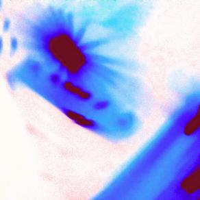 Chiazze di Sangue giù per lo Sciacquone