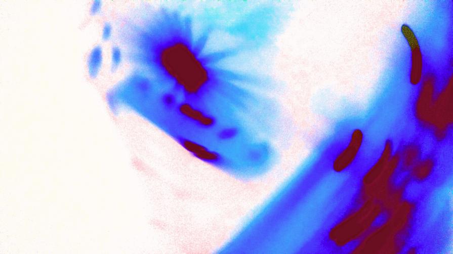 Chiazze di Sangue giù per lo Sciacquone