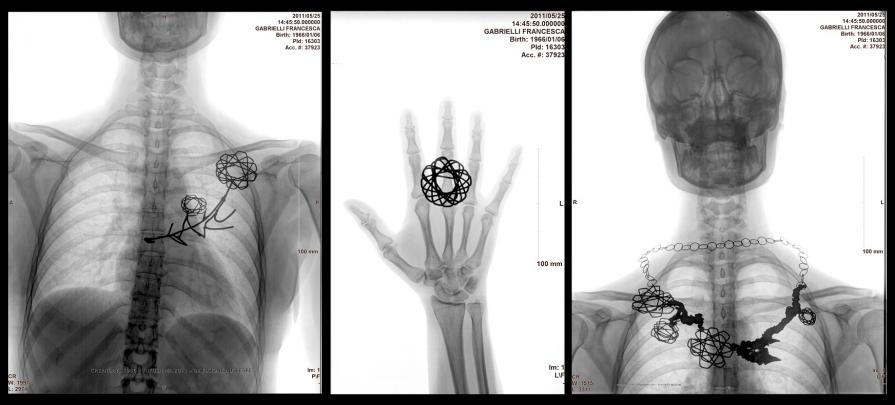 Chernobyl 1986 - Fukushima 2011 - trittico Chernobyl 1986 - Fukushima 2011 - trittico