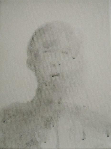 low level neurologic state