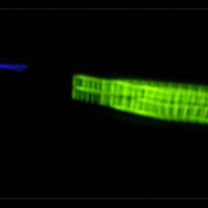 numerical progression