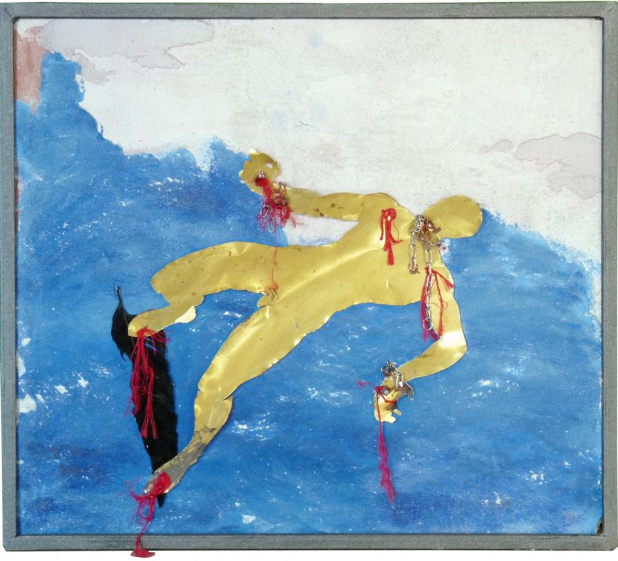 Miopia cronica Miopia cronica