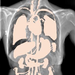 visceral and skeletal visceral and skeletal