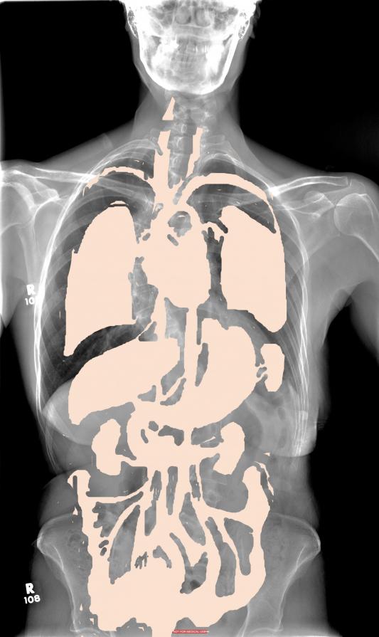 visceral and skeletal