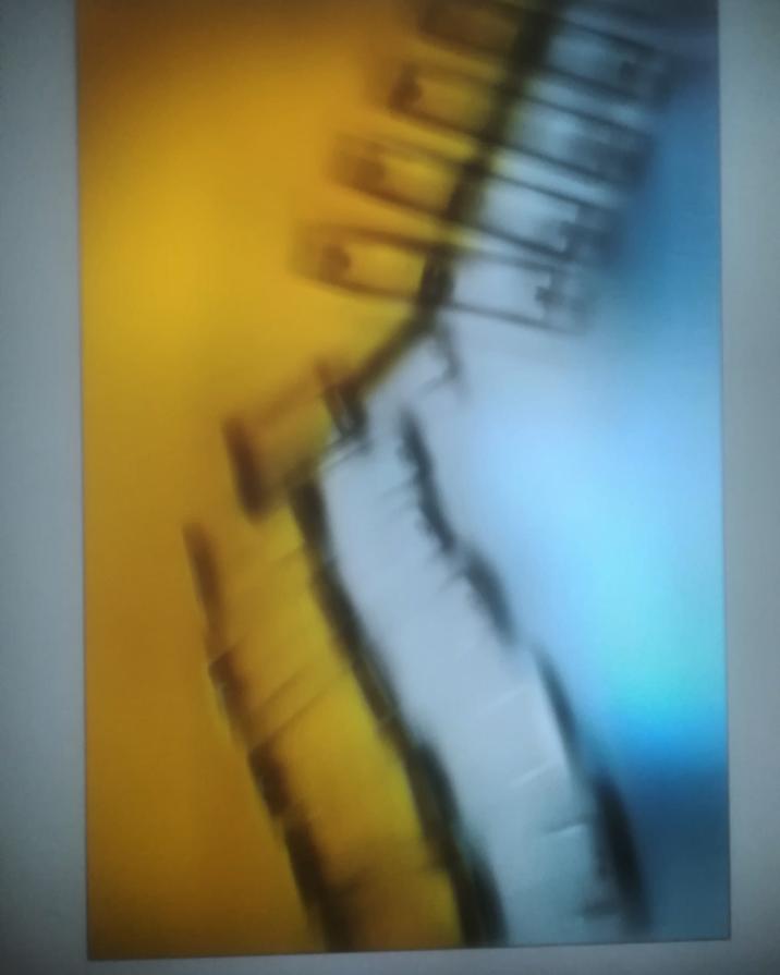 Ricucire é un dono. 