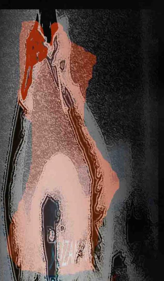 A pain flies around me