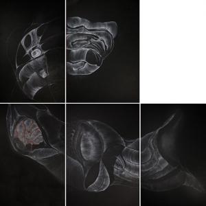 (LIQUIDO CEREBROSPINALE)In assenza di ritmo/IN THE ABSENCE OF RHYTHM 2 