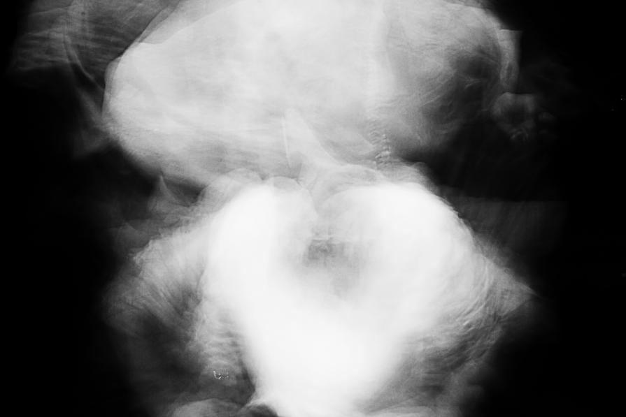 Negli  spazi  del  Lolli