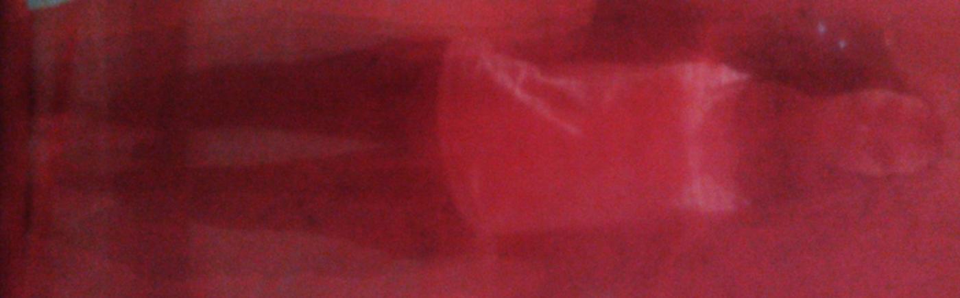 NOTTE ROSSA VOLTERRA - REFUGEES II - Klemenz