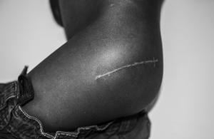 Daniele Stefanizzi - Street scar