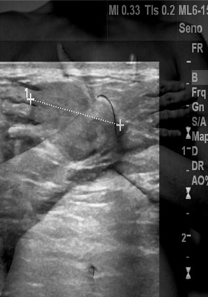 OfficinARS Fotografia. Durante e dopo: Resilienza OfficinARS Fotografia. Durante e dopo: Resilienza