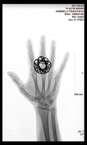 Francesca Gabrielli - Chernobyil 1986 - Fukushima 2011 - X-ray - ring - 2011 .jpg