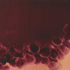 Red gravity-Landscape