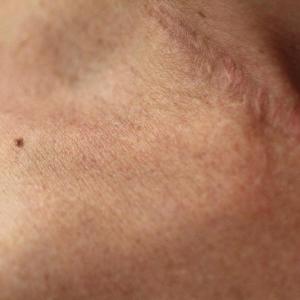 Autobiografia 1 Autobiografia 1