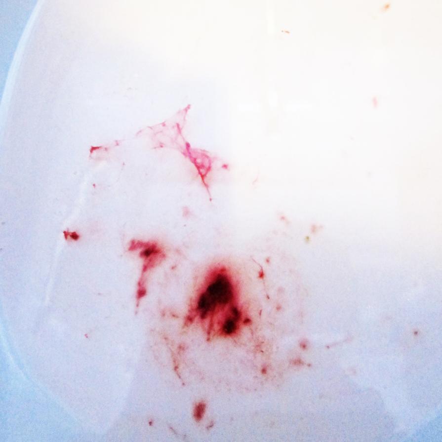 Bloody sprite 2 Bloody sprite 2