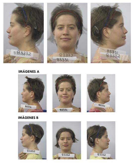 FROM FALSE TWINS TO REAL TWINS FROM FALSE TWINS TO REAL TWINS