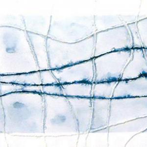 MAD on Paper -  Aldamaria Gnaccarini - "Superfici Sensibili"