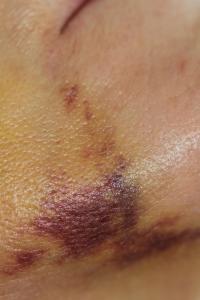 Nancy Wyllie - Skintight