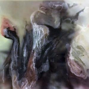 Roseo Anellide Ermafrodito