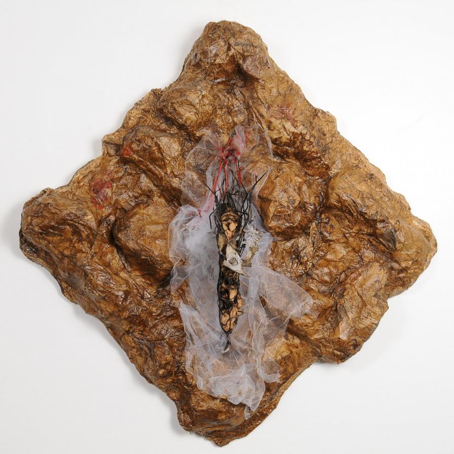 LUPUS IN FIBULA LUPUS IN FIBULA