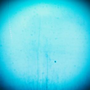 Dopo la valanga   ( After the avalanche ) 