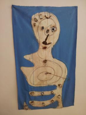 L'Uomo e le pietre del suo Intestino!