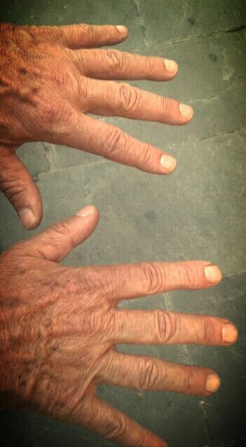 endless live support