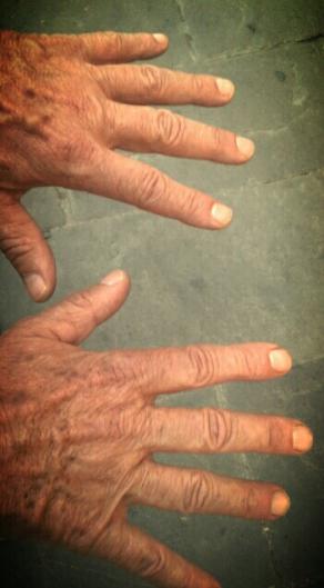 endless live support