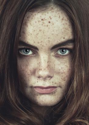 "beautiful freckles"