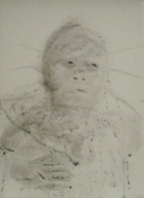 low level neurologic state