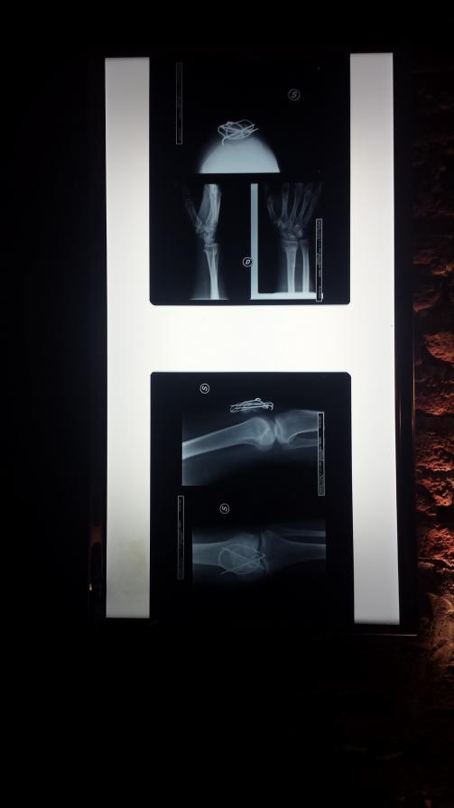 Fratture (...) di vita Fratture (...) di vita