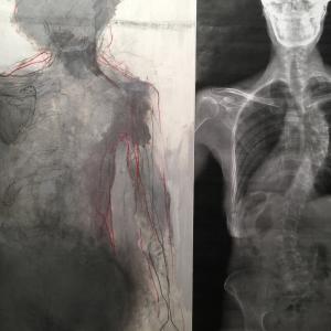 in the body in the body