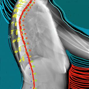 spine profile drawing on x=ray spine profile drawing on x=ray