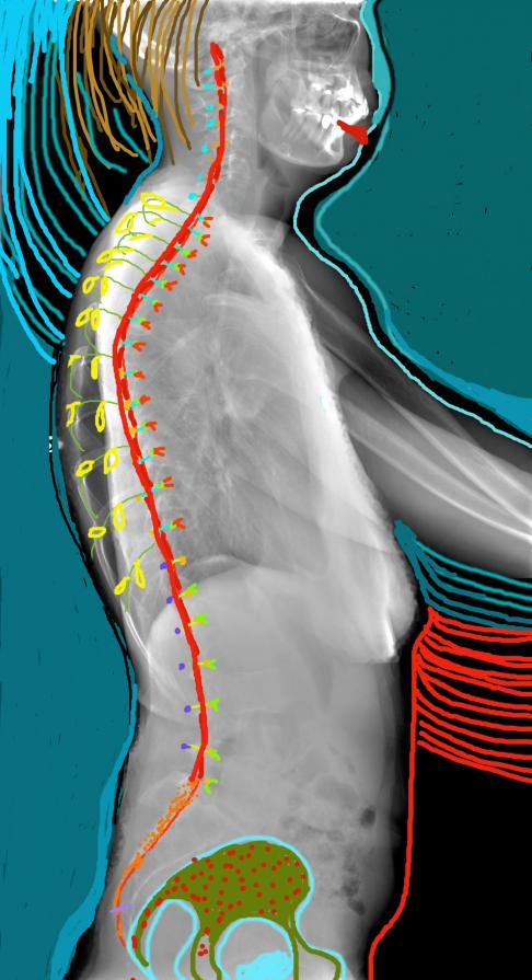 spine profile drawing on x=ray