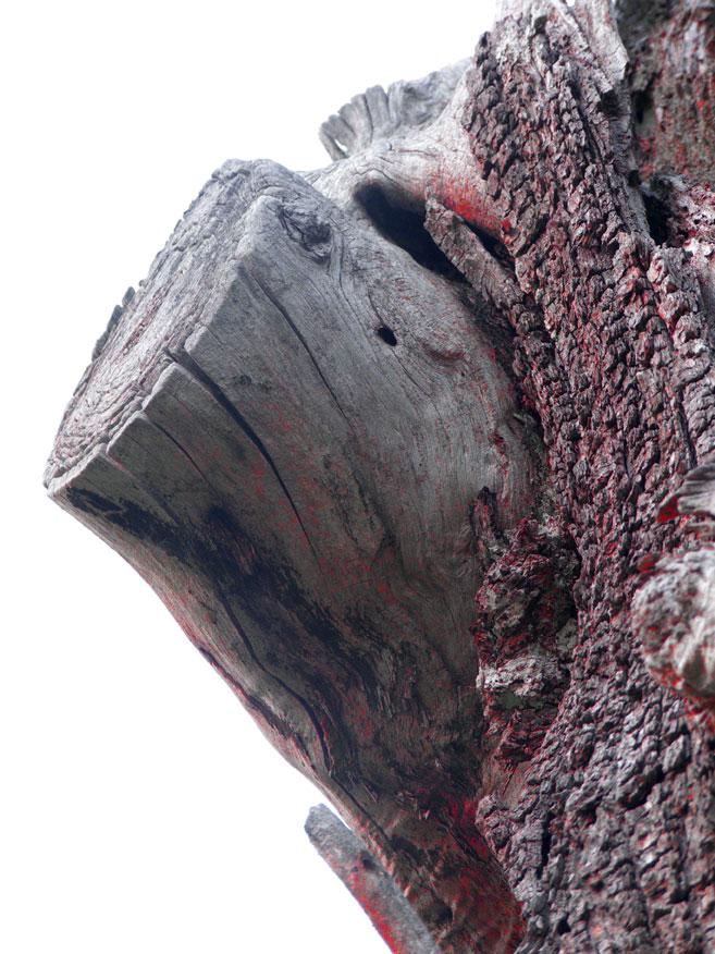 amputazione amputazione