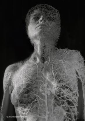 Metamorfosi Metamorfosi