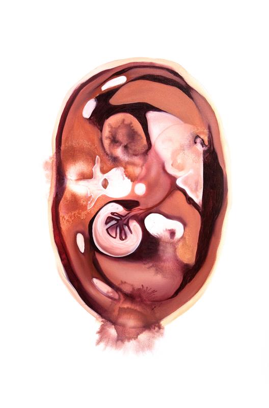 Strong magnetic fields can interfere with certain implants. Strong magnetic fields can interfere with certain implants.